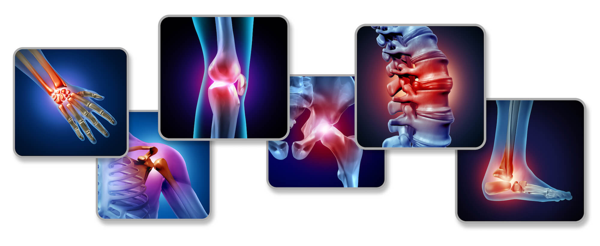 Chronic Joint Pain Photobiomodulation Could be the Solution